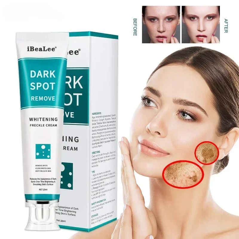 Skincare Glowing - Crema blanqueadora para pecas, elimina las