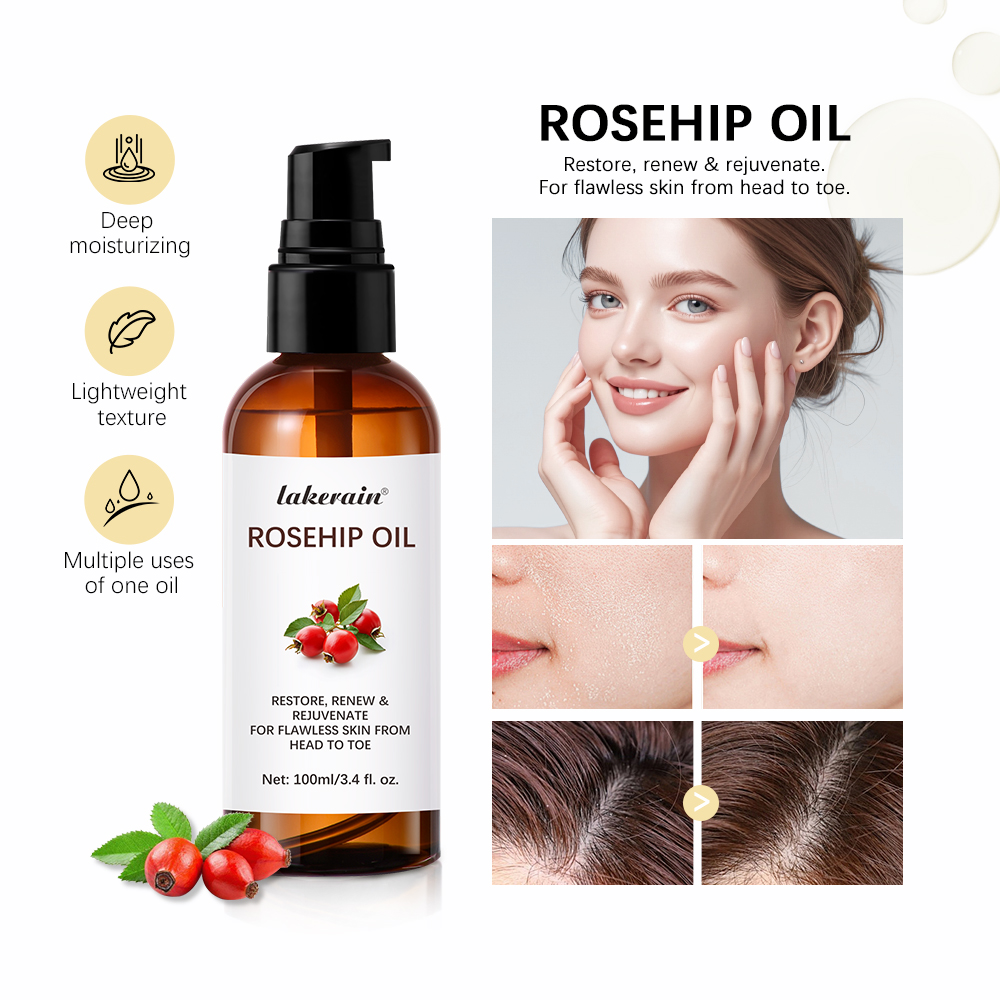 Face Oil Rosehip - Aceite Esencial de rosa mosqueta hidratante