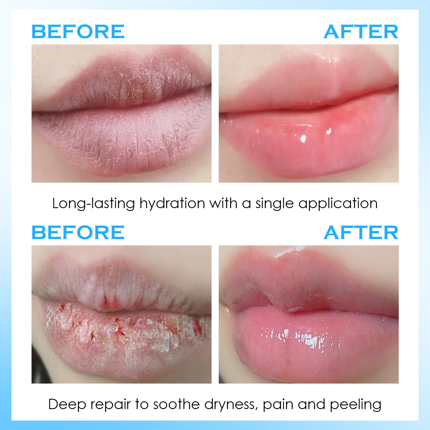 Sérum labial hidratante, bálsa - Lip Balm reseña y precio