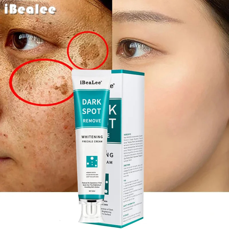 Crema blanqueadora para pecas, - Skincare Glowing reseña y precio
