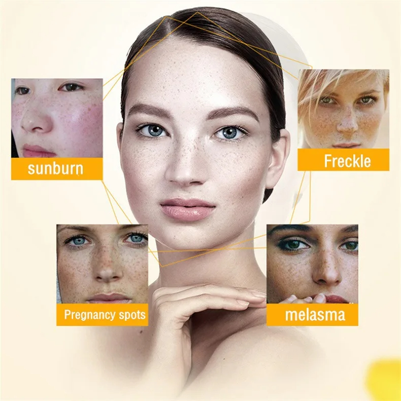 Crema blanqueadora para pecas, - Skincare Glowing reseña y precio