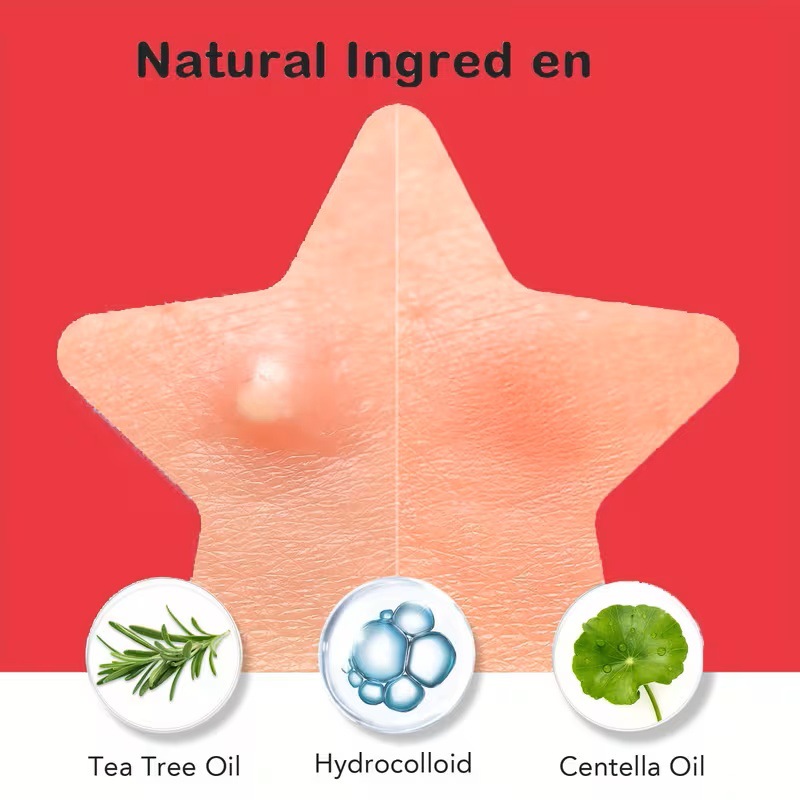 200/400 Parches para Acné de T - Face Oil reseña y precio