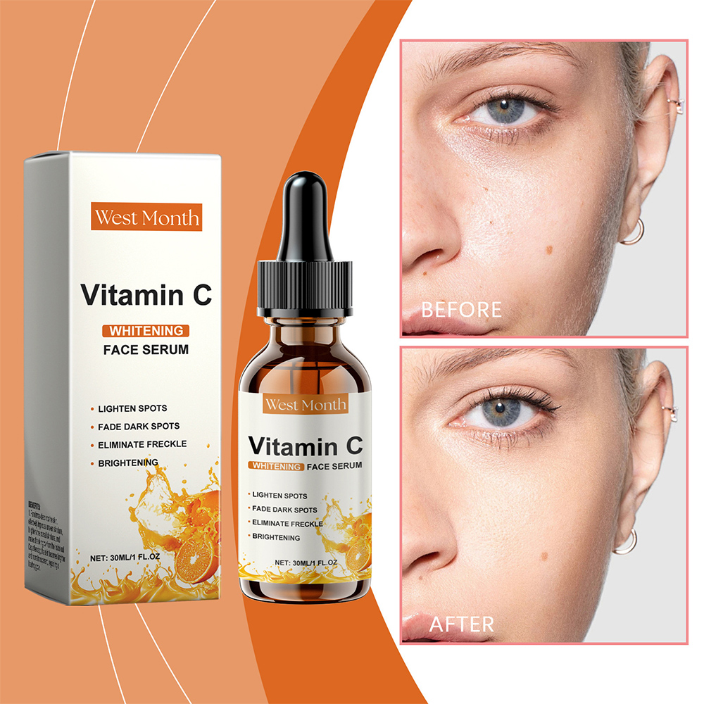 Suero Facial de Vitamina C Wes - Skincare Glowing reseña y precio